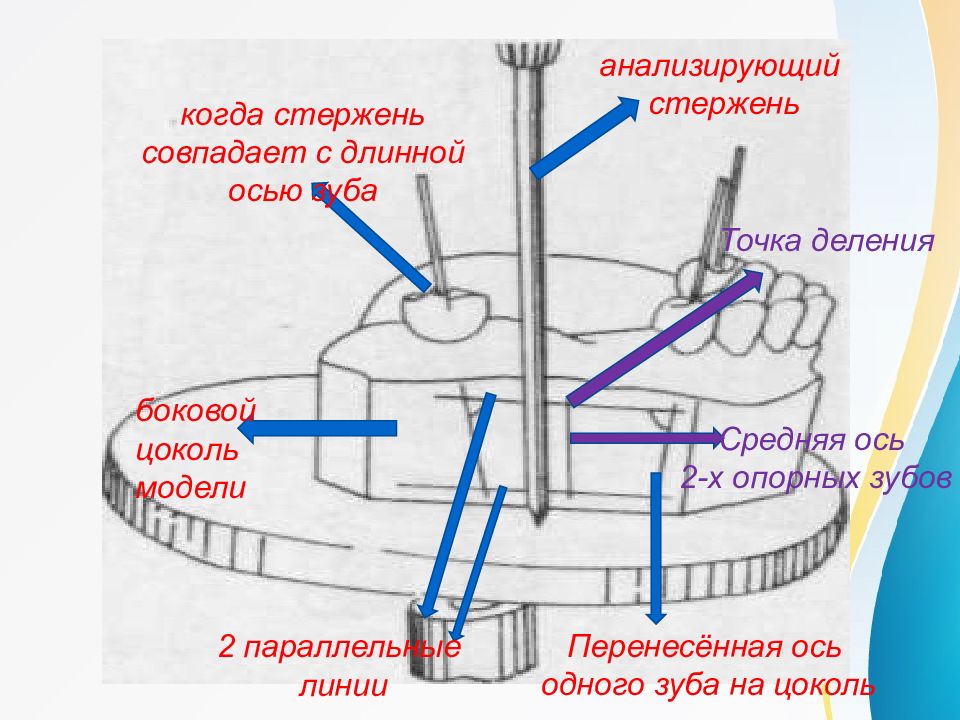 Презентация на тему параллелометрия