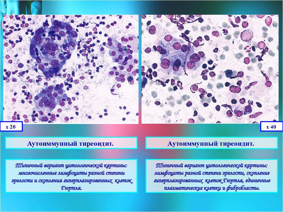 Диагностика заболеваний щитовидной железы презентация