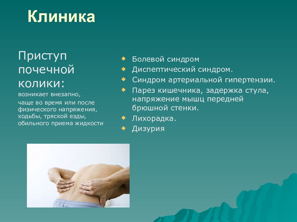 Почечная колика симптомы. Осложнения почечной колики. Симптомы почечных приступов. Основные проявления почечной колики. Объективные симптомы при почечной колике.