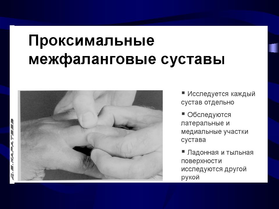 Суставной синдром у детей презентация