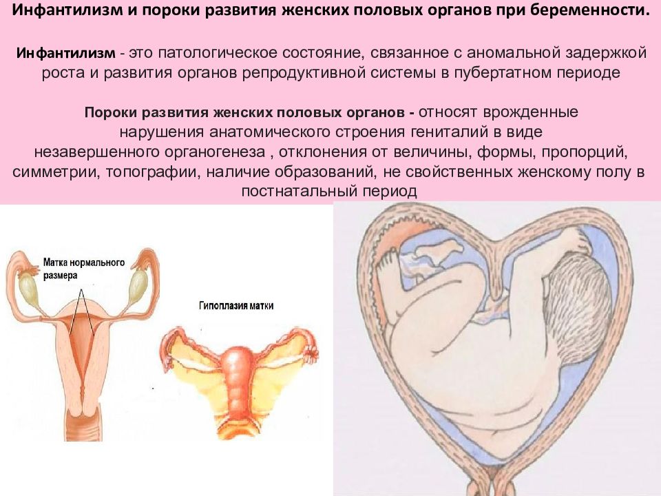 Аномалии развития женской репродуктивной системы презентация