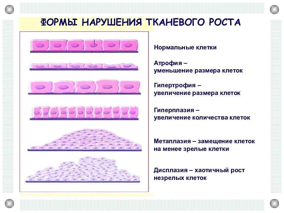 Нормальные клетки. Схема гипертрофии и гиперплазии в сравнении с нормальной клеткой. Нормальные клетки гипертрофия гиперплазия. Схема гипертрофии и гиперплазии в Сраанение с нормальной клеткой. Гиперплазия Размеры клеток.