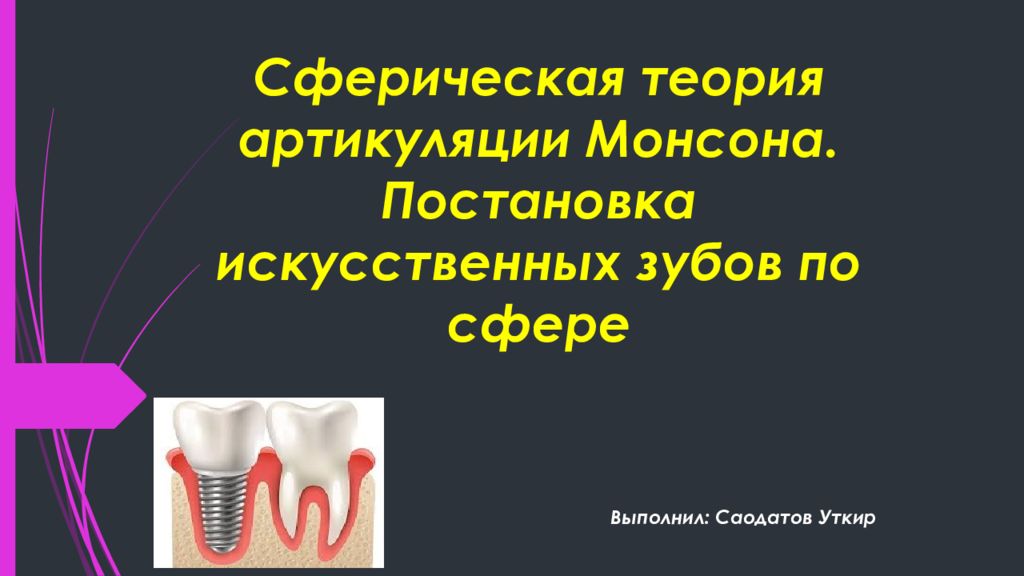 Постановка зубов по сферическим поверхностям презентация