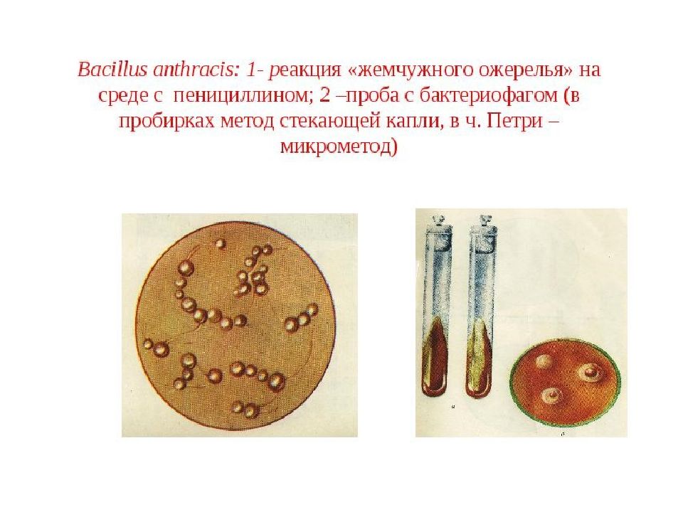 Материал для исследования сибирской язвы. Аллергическая проба при сибирской язве. Сибирская язва презентация. Сыпь при сибирской язве. Сибирская язва презентация для школы.