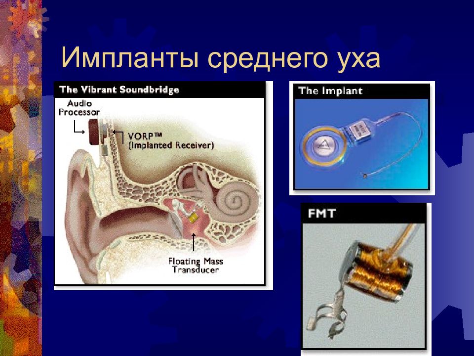 Заболевания внутреннего уха презентация