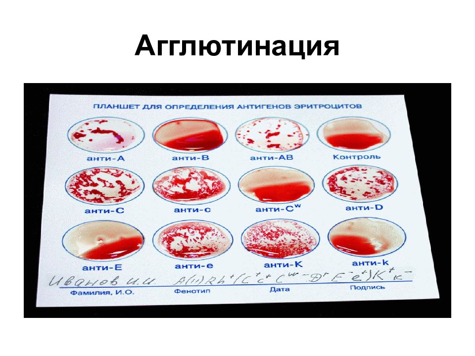 Группа крови агглютинация картинки