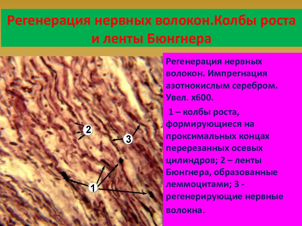 Регенерация нервной ткани презентация