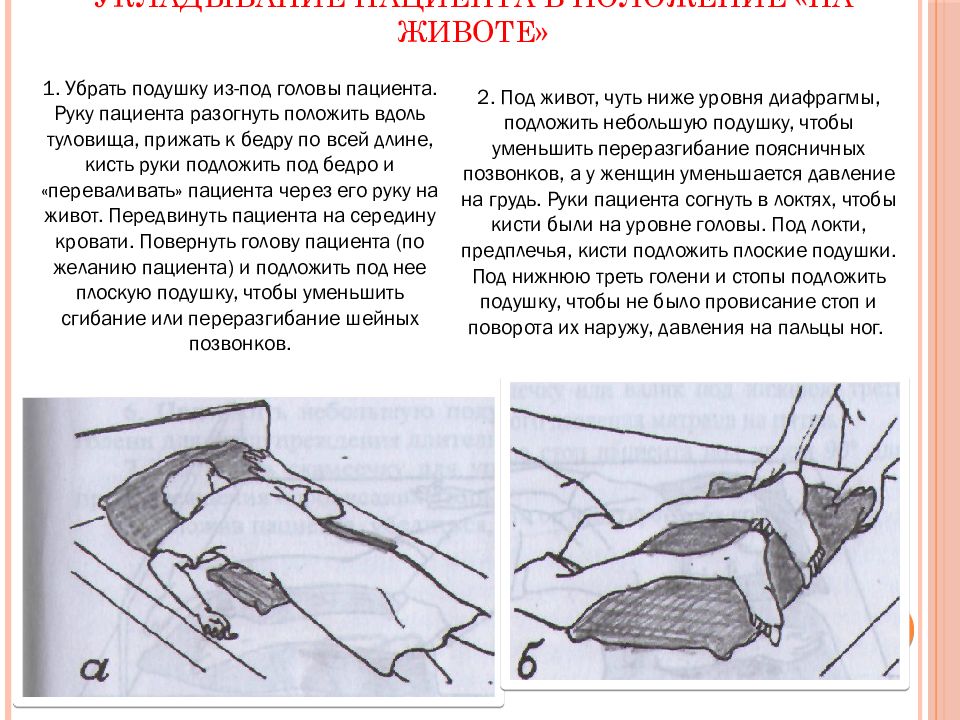 552 положение. Положение на животе. Правильное положение больного. Положение лежачего больного. Прональная позиция пациента- это.