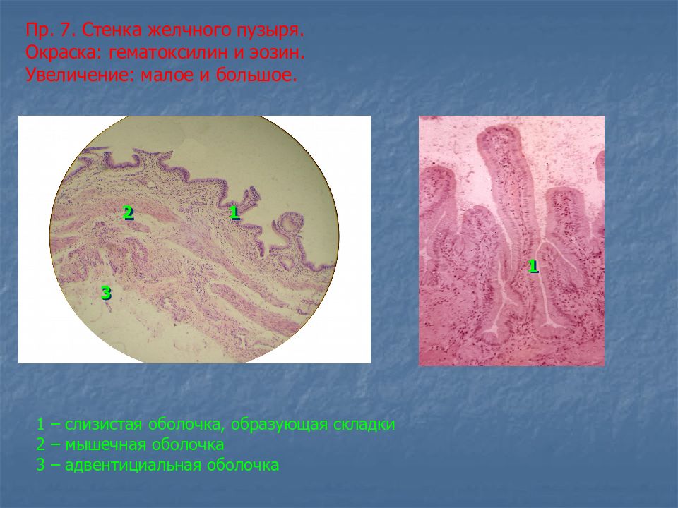 Увеличенная малая. Желчный пузырь окраска гематоксилин-эозином. Желчный пузырь гематоксилин-эозин. Желчный пузырь гистология препарат. Стенка желчного пузыря гистология.