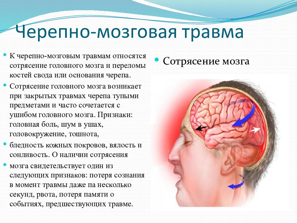 Удар головы затылком. Симптоматика сотрясения головного мозга обуславливается. Три основных признака при сотрясении головного мозга.. Черепно мозговая травма ушиб мозга. Сеоепно мозгоапя Травиа.