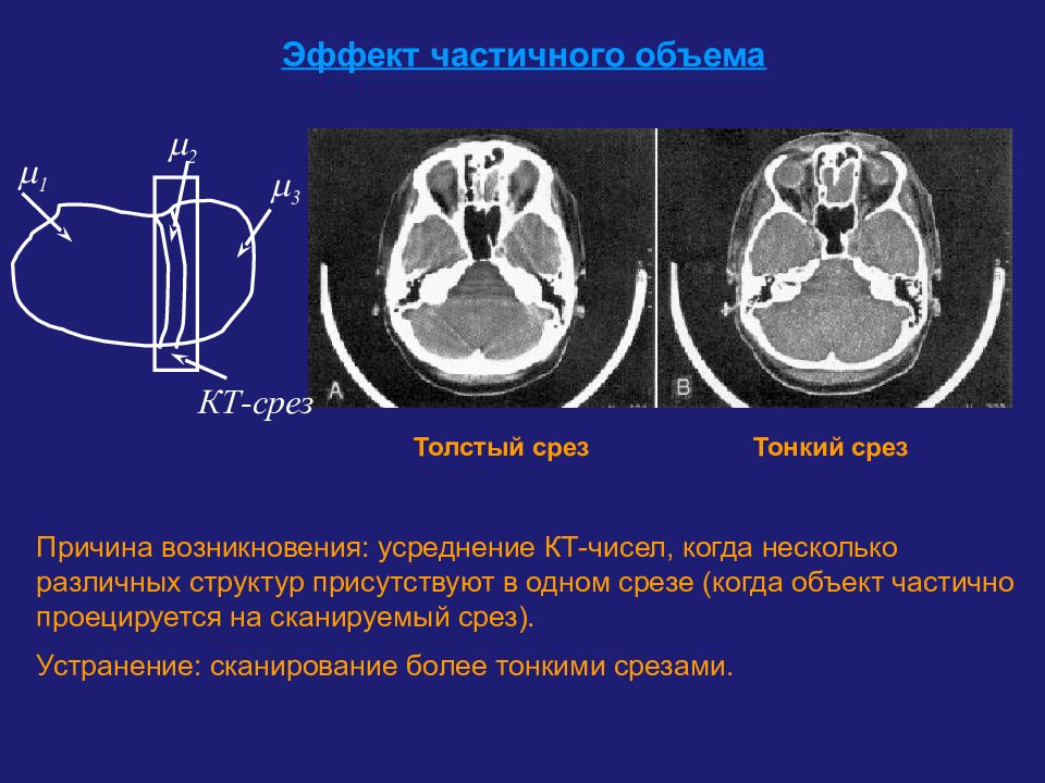 Mip изображение кт