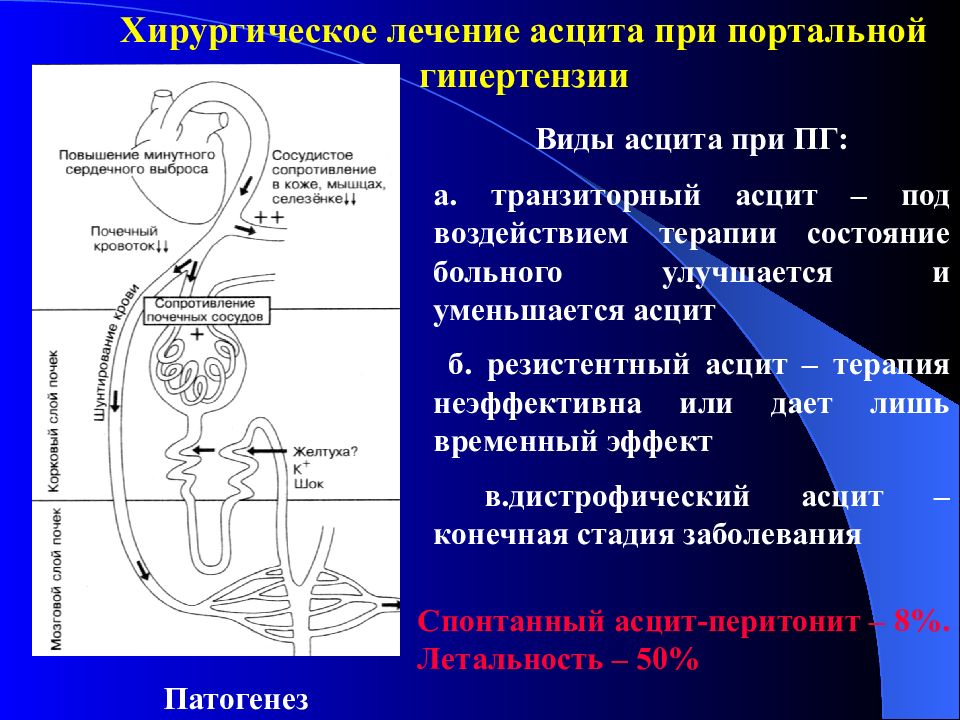 Операция гипертония. Асцит хирургическое лечение. Операции при портальной гипертензии. Хирургическое лечение портальной гипертензии. Операции при портальной гипертензии Оперативная хирургия.