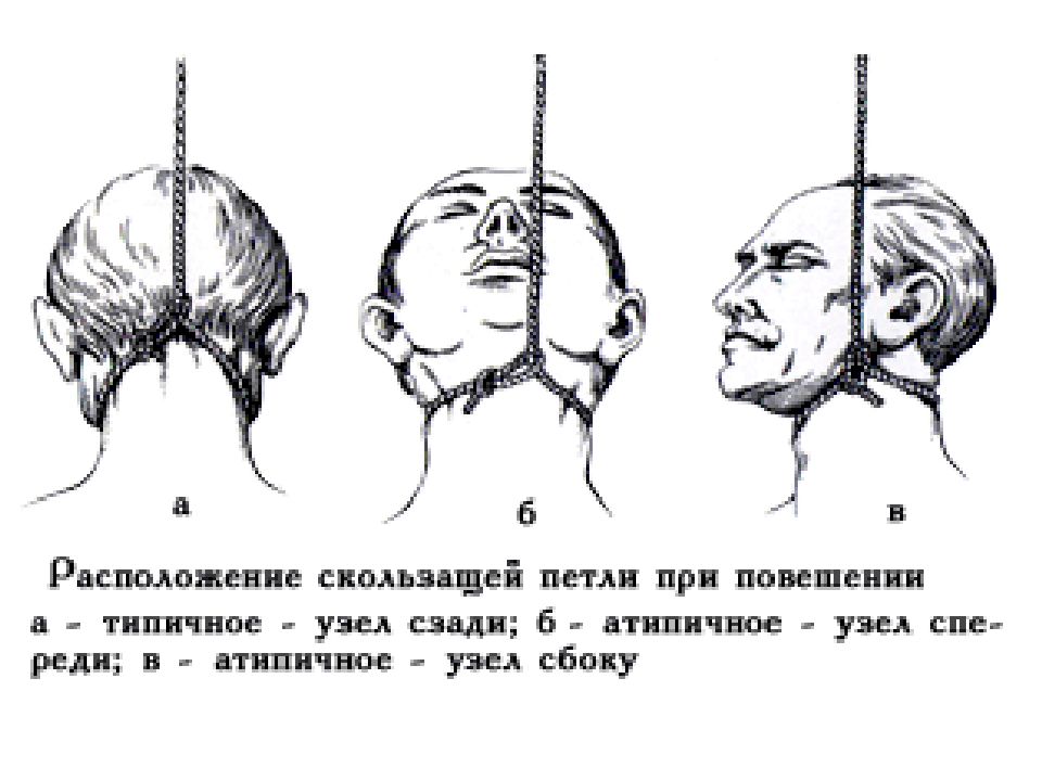 Рисунок человек в петле