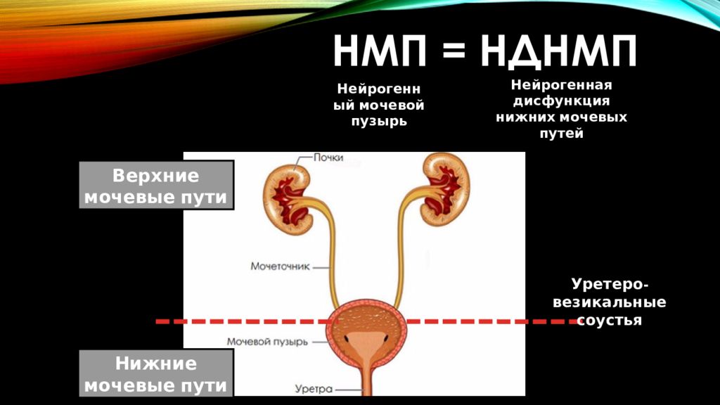 Гиперактивный мочевой пузырь код по мкб 10. Верхние и нижние мочевые пути. Верхние мочевыводящие пути. Нейрогенный мочевой пузырь. Классификация нейрогенной дисфункции мочевого пузыря.