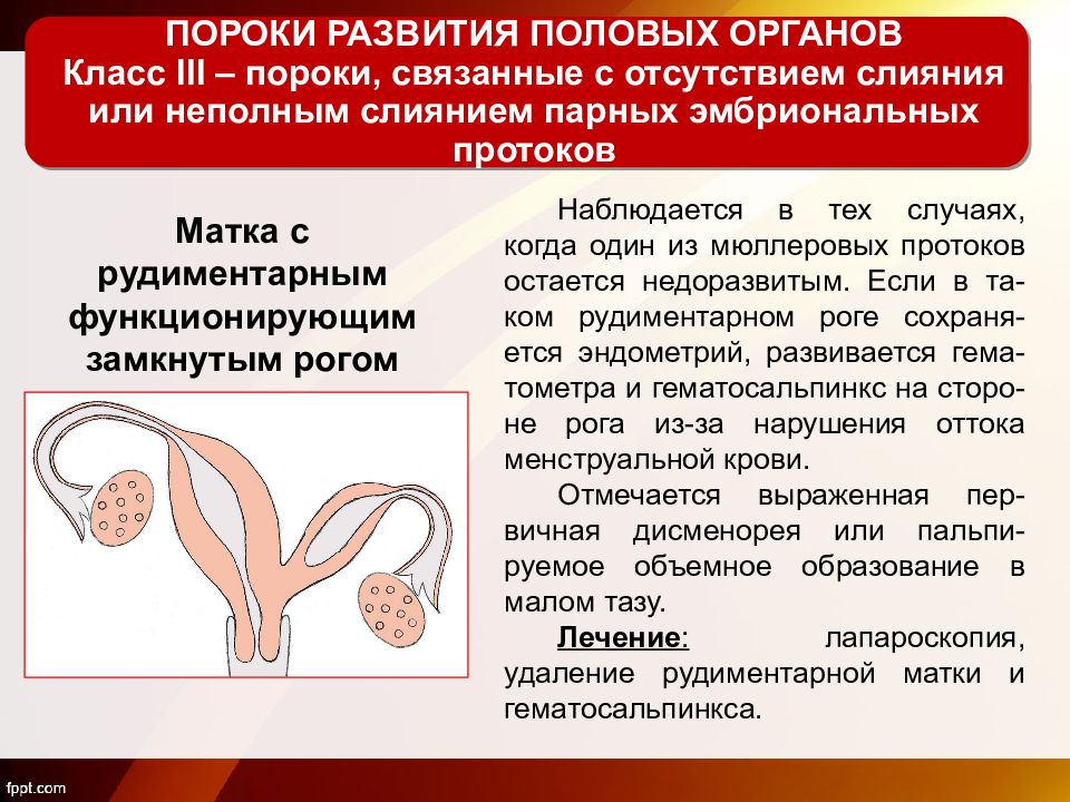 Аномалии развития мужских половых органов презентация