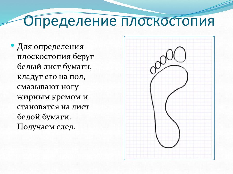 Лабораторная работа по биологии плоскостопие. Выявление плоскостопия. Выявление плоскостопия по отпечатку стопы. Выявление плоскостопия рисунок. Измерение ноги для выявление плоскостопия.