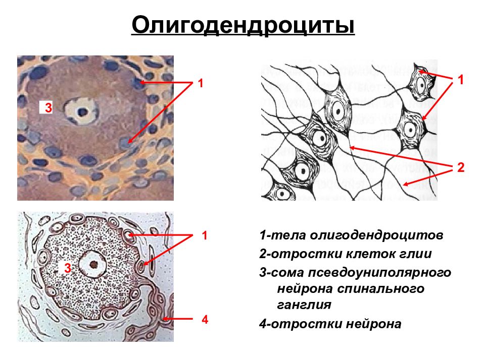 Отростки клетки. Нервная ткань олигодендроциты. Олигодендроциты гистология препарат. Олигодендроглия гистология препарат. Олигодендроглия структура и функции.