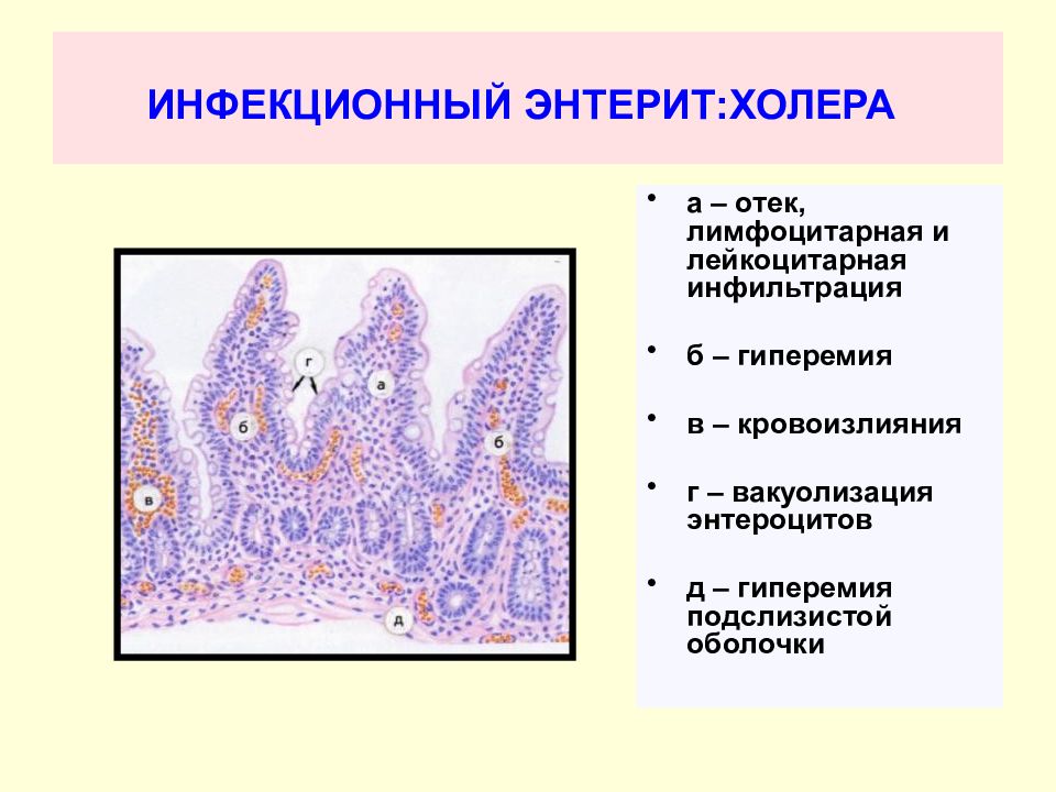 Инфекционные болезни патанатомия презентация