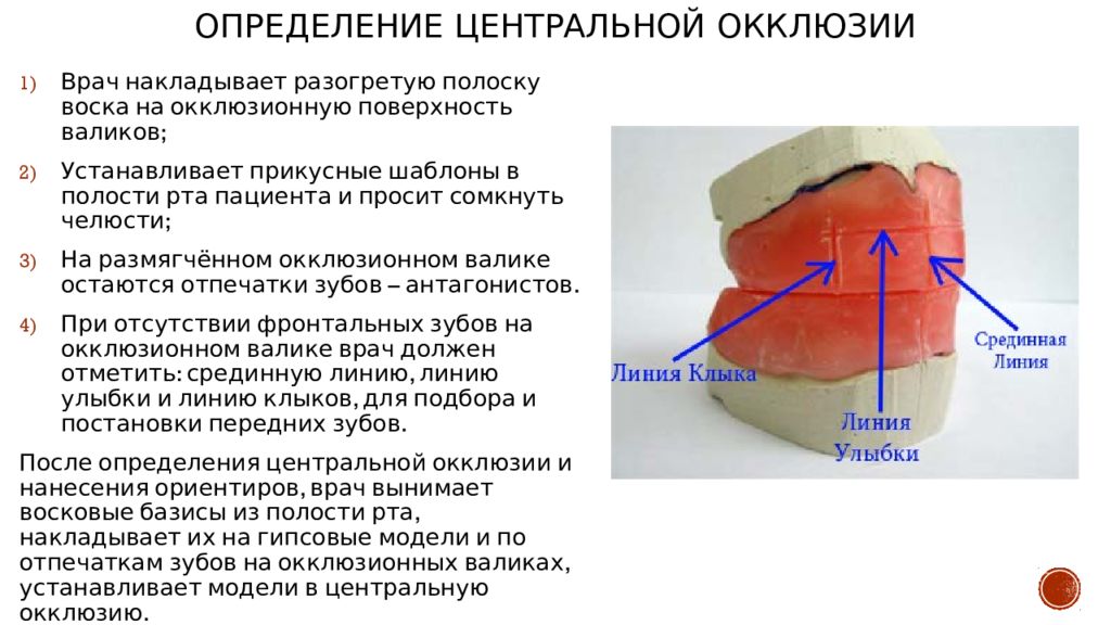 Изготовление воскового базиса с окклюзионными валиками презентация