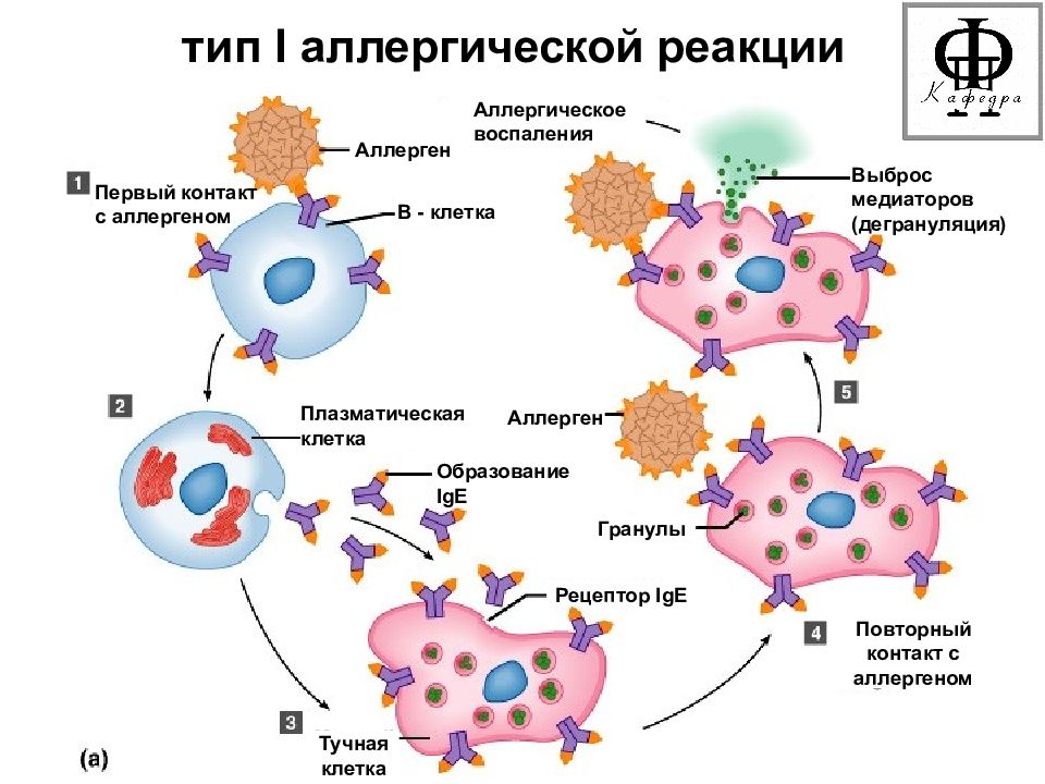 Иммунный ответ белки. Схема аллергической реакции 1 типа иммунология. Механизм развития аллергии 1 типа. Аллергическая реакция первого типа патогенез. Механизм развития аллергической реакции схема.