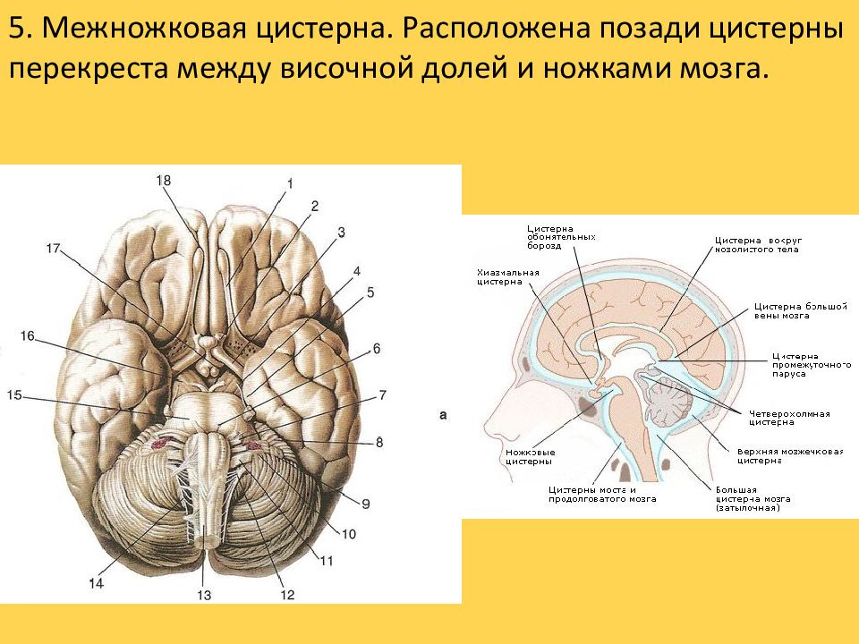 Цистерны мозга. Межножковая цистерна головного мозга. Цистерны основания головного мозга. Цистерна латеральной ямки большого мозга. Расширение четверохолмной цистерны головного мозга.