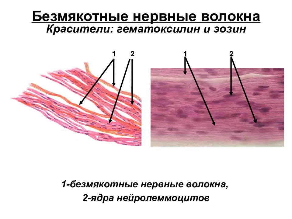 Безмиелиновые нервные волокна рисунок