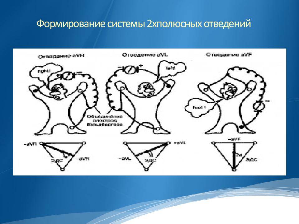 Две системы. Основные электрографические отведения животных. ЭОС И типы телосложения. ЭОС сердца объемная картинка.