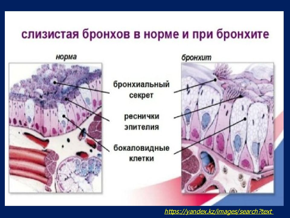 Стенка бронхиол образована тканью