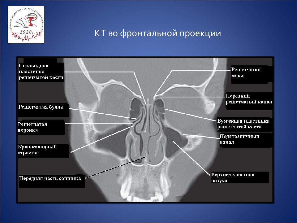 Проекция носа. Кт носа фронтальная проекция. Кт анатомия носа. Проекции кт носа анатомия. Строение пазух на кт.