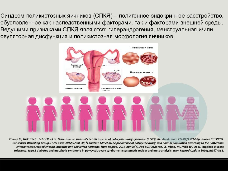 Поликистоз яичников презентация