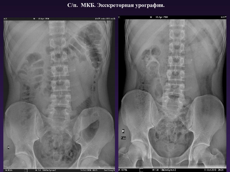 Урография как проводится