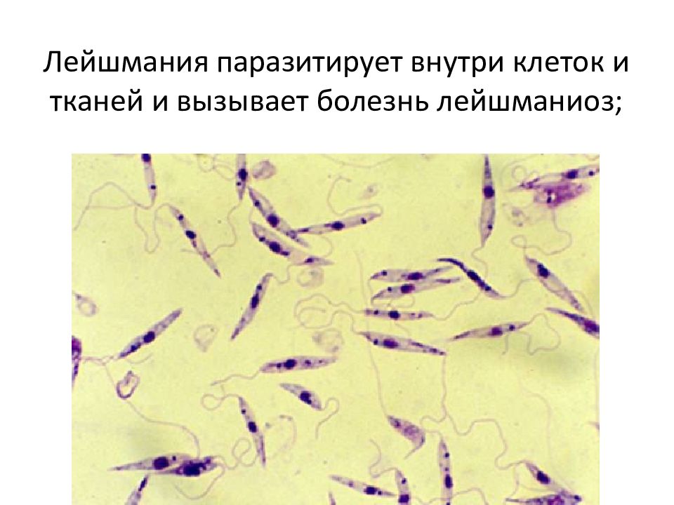 Лейшмании. Leishmania donovani промастигота.