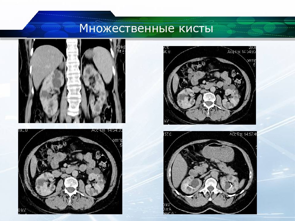 Кт почек презентация