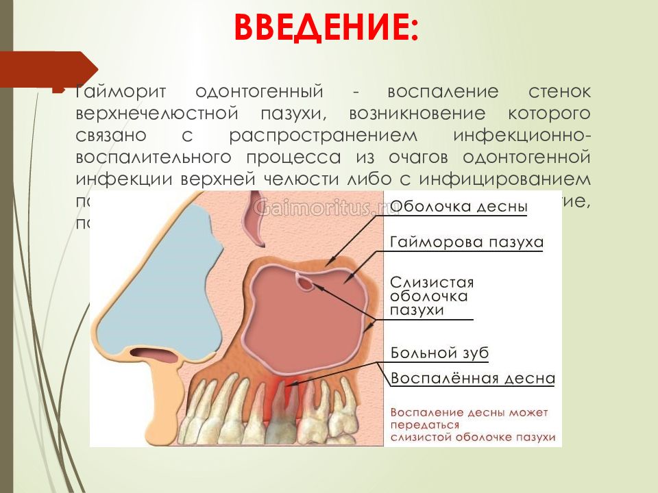 Правая верхнечелюстная пазуха где находится картинка