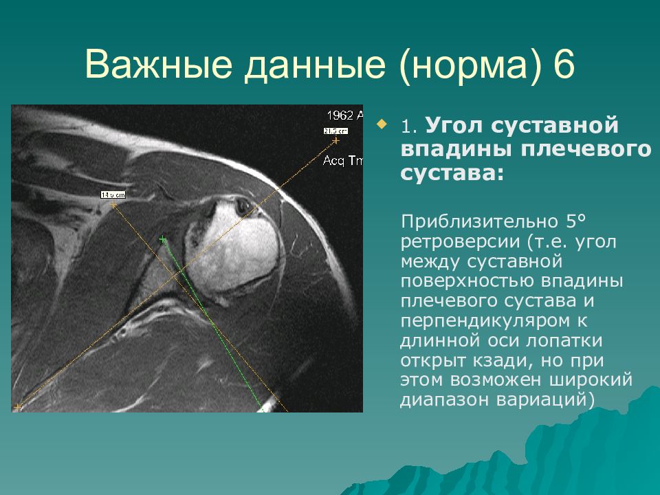 Мрт Плечевого Сустава Цена