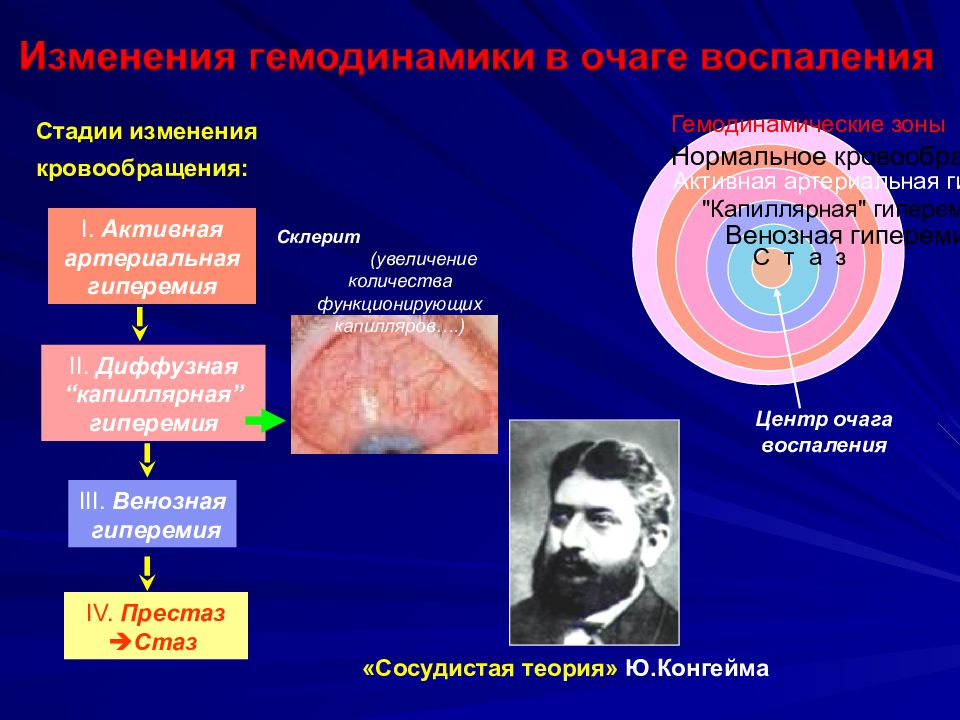 Артериальная гиперемия воспаление