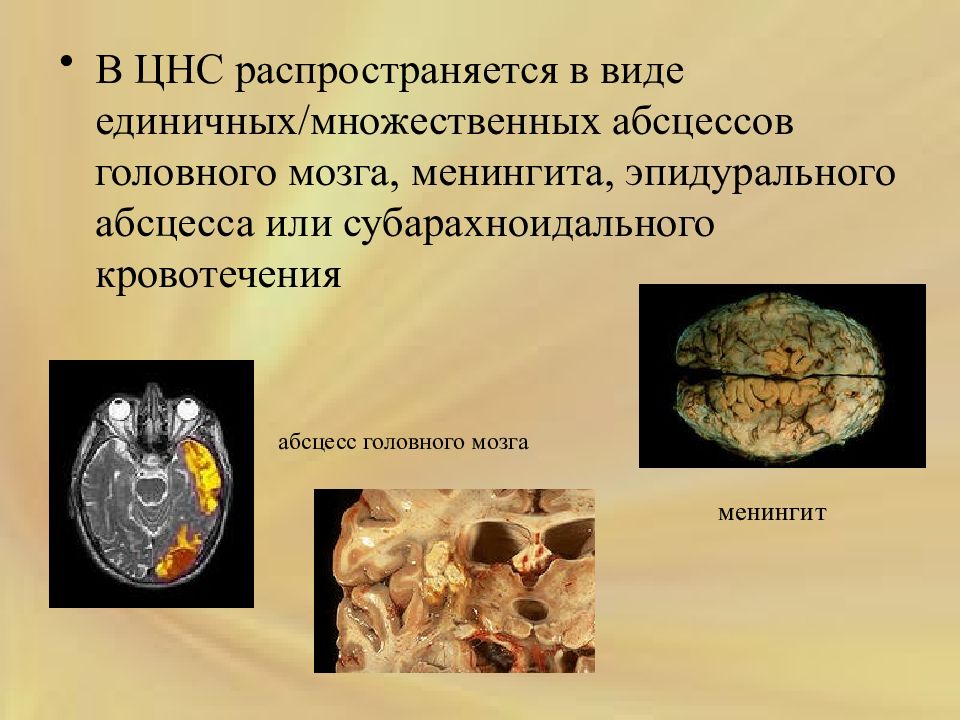 Аспергиллез пчел презентация