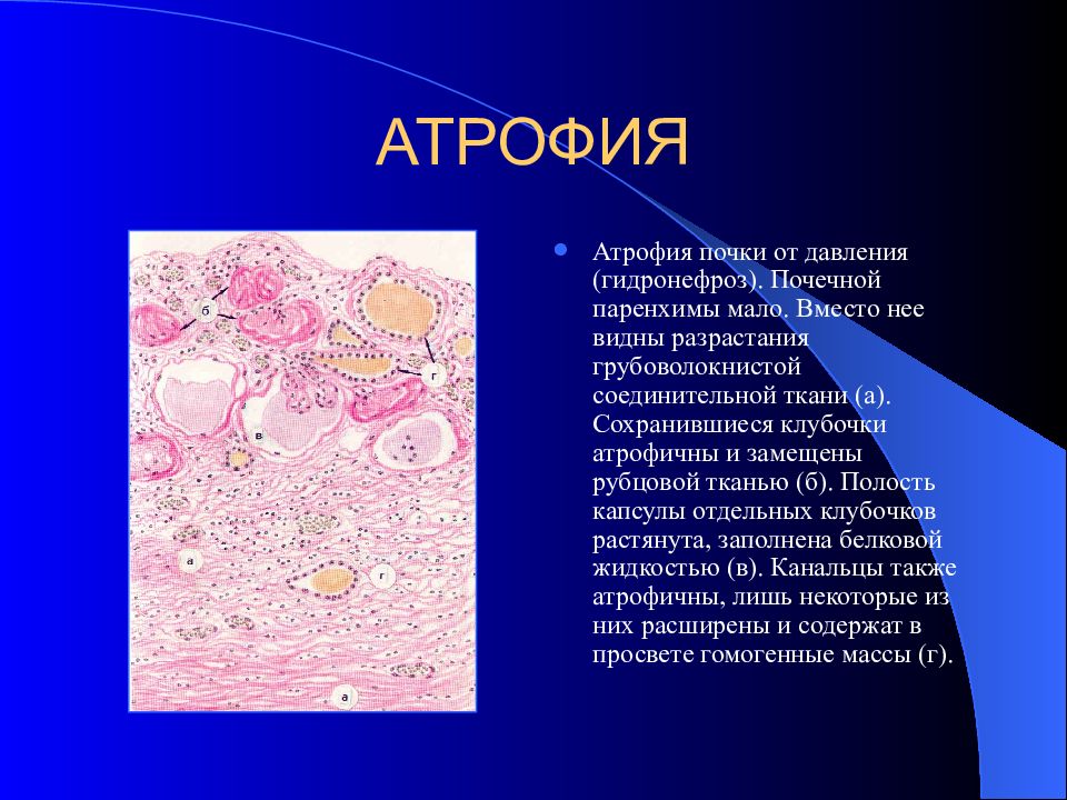 Презентация атрофия и склероз