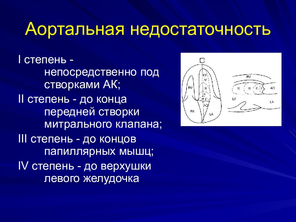 Аортальная недостаточность презентация