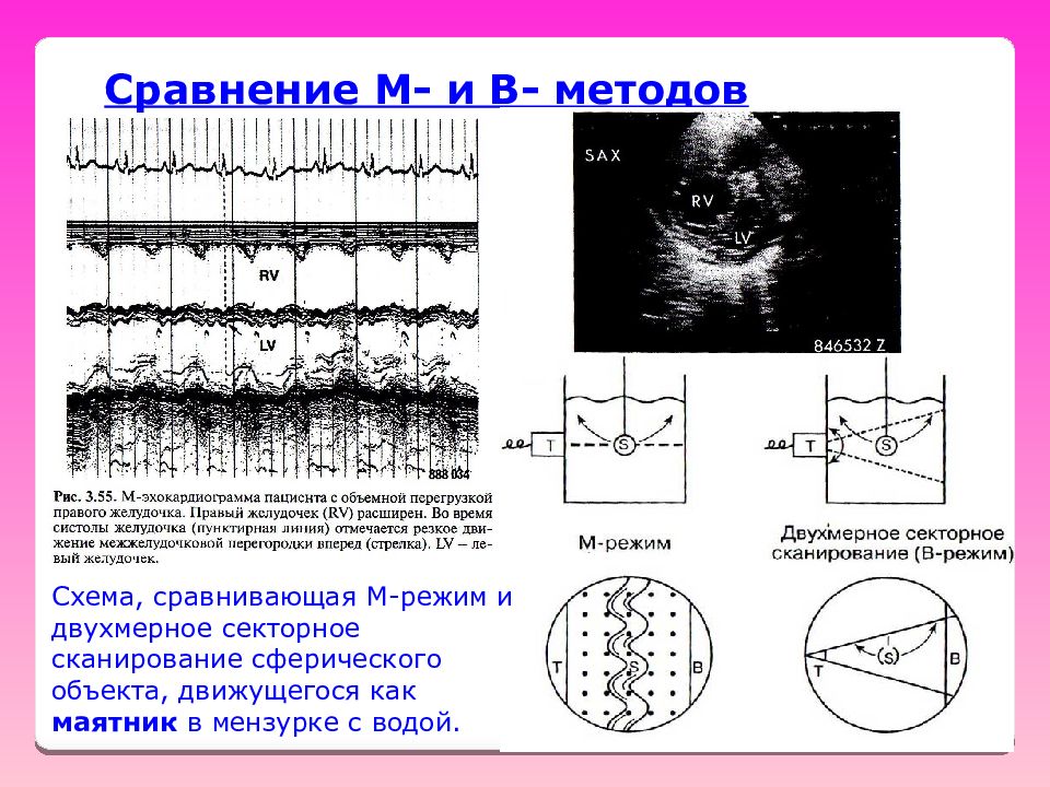 B метод. Секторное сканирование. Двухмерное сканирование. Сравнение режимов бокового сканирования.