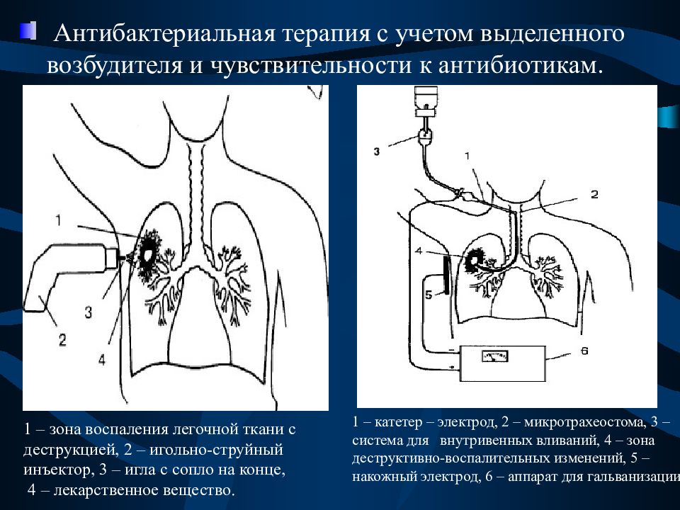 Поражение легочных тканей. Разряжение легочной ткани. Деструкция легких возбудитель. Нагноительные заболевания клинические рекомендации органов дыхания. Деградация легочной ткани.