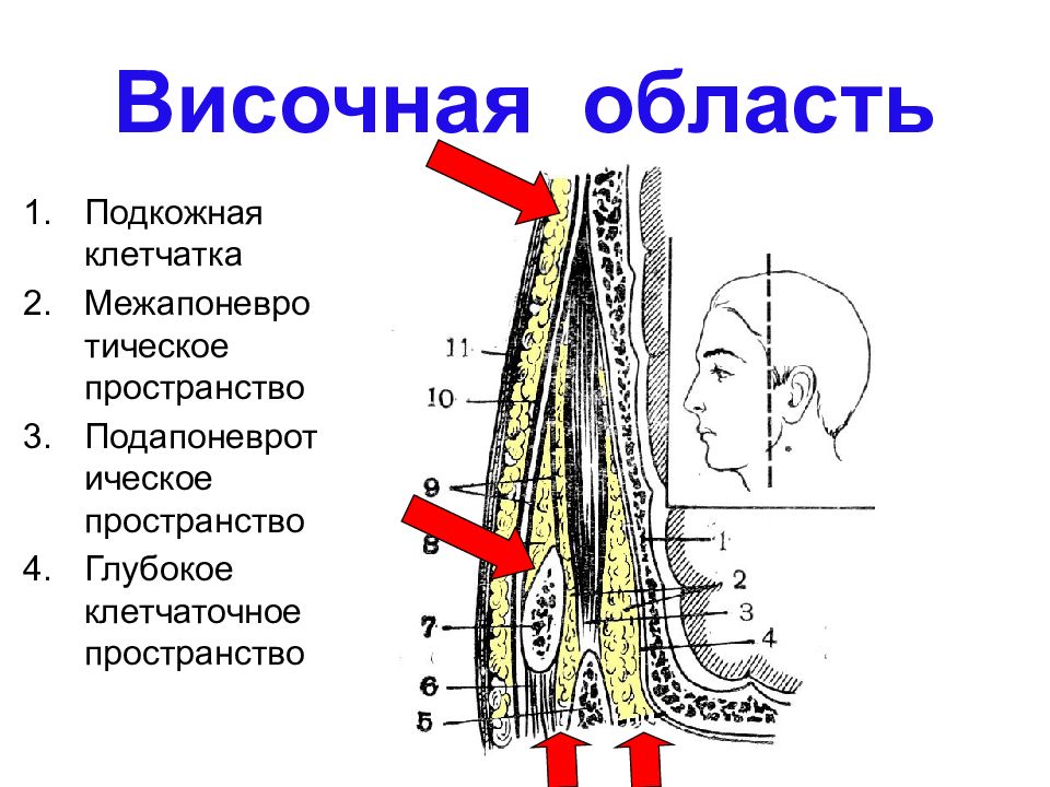 Сообщения клетчаточных пространств височной области. Межапоневротическое височное пространство. Послойное строение височной области. Флегмона височной области. Межапоневротическое пространство височной области.