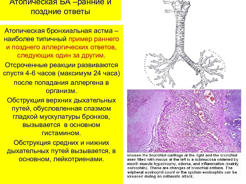 Атопическая форма бронхиальной астмы