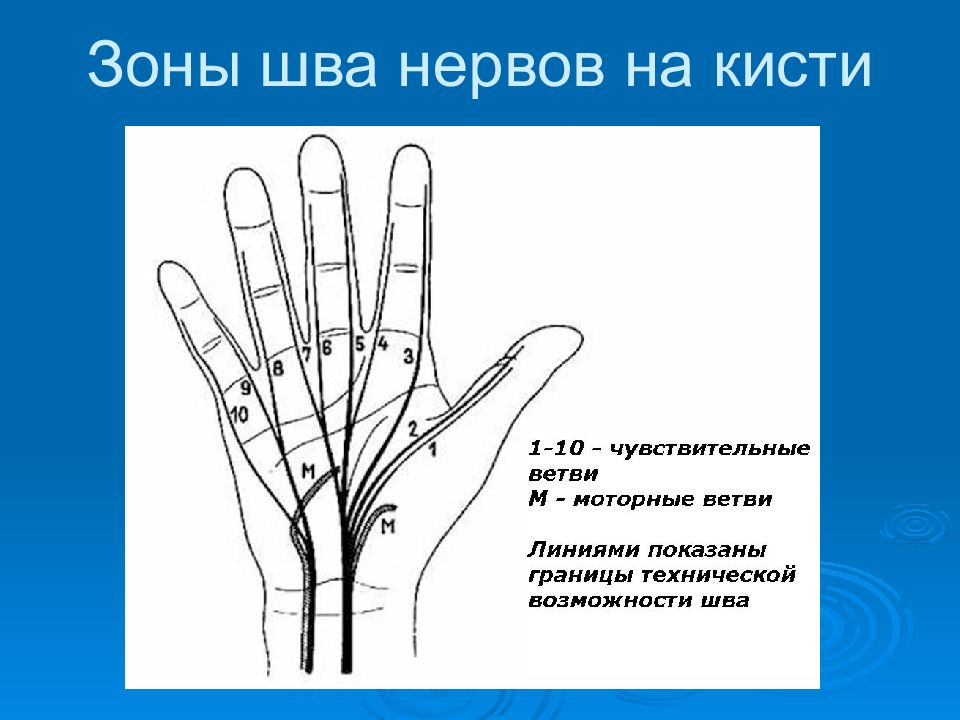 зоны кисти. зона запястья. зоны разгибателей кисти сухожилий. нервные окончания на пальцах рук. проксимальная поперечная складка ладони.