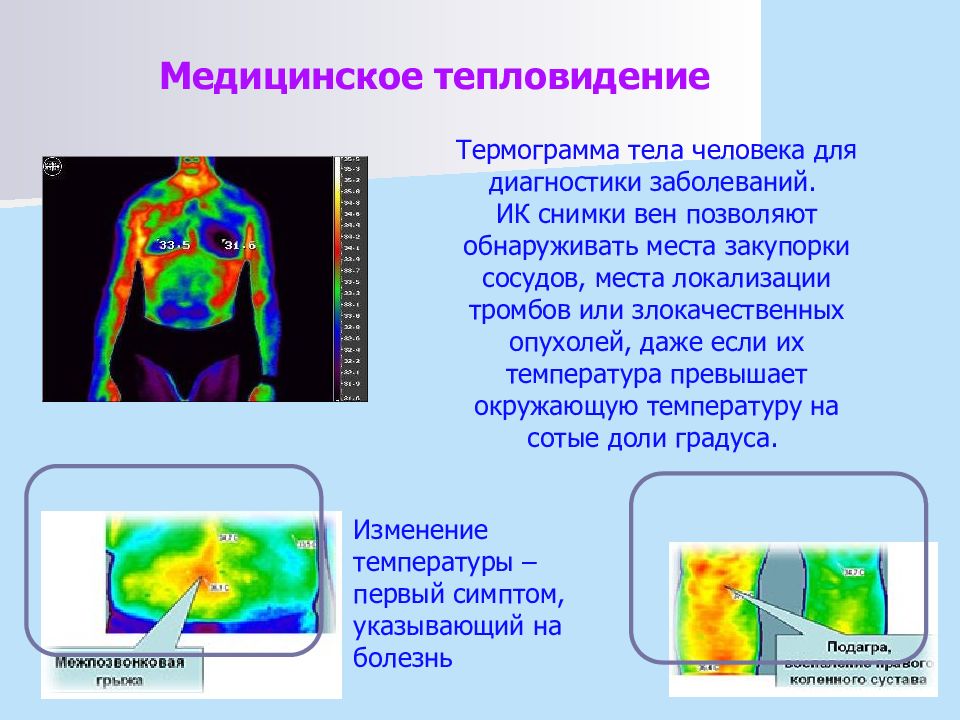 Организм использование. Термография в медицине. Термография слайд. Термограмма тела человека. Медицинское тепловидение.