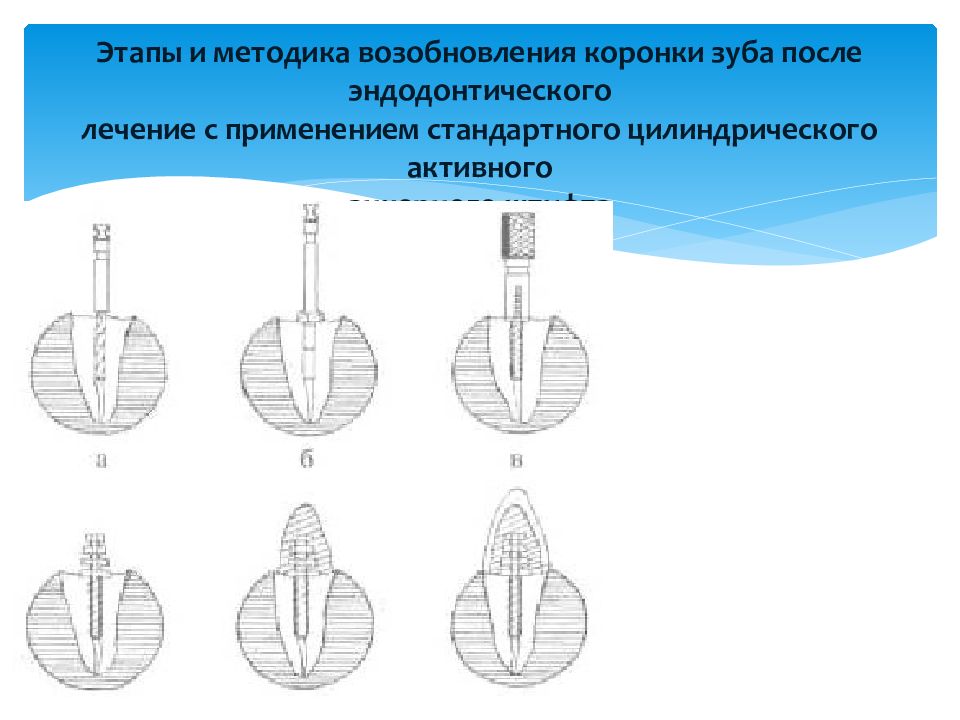 Штифтовые конструкции презентация