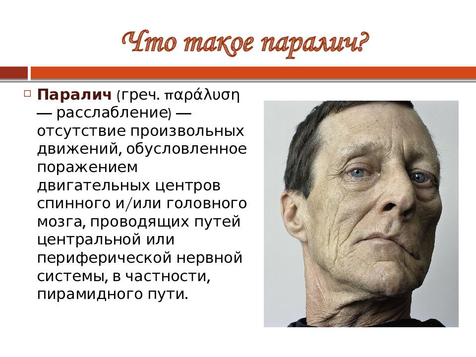 Парез лицевого нерва мкб 10. Центральные парезы и параличи. Периферический паралич. Центральный и периферический паралич.