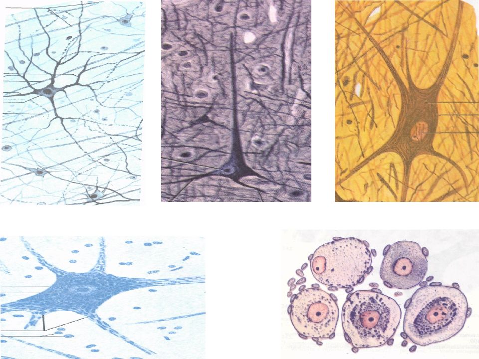 Соединительная нервная ткань. Нейроглия гистология препарат. Нервная ткань гистология. Микропрепараты клетки нервной ткани. Нервная система препараты гистология.