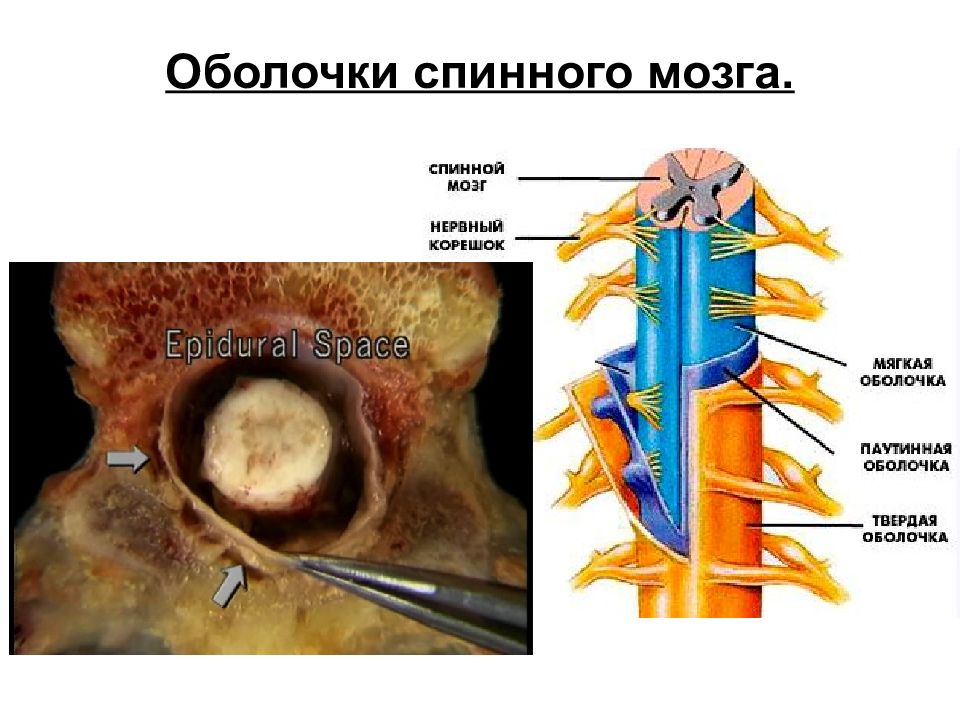 Жидкость в спинном канале