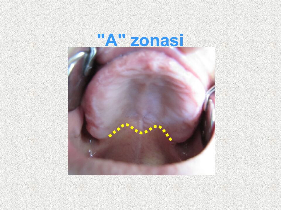 "A" zonasi